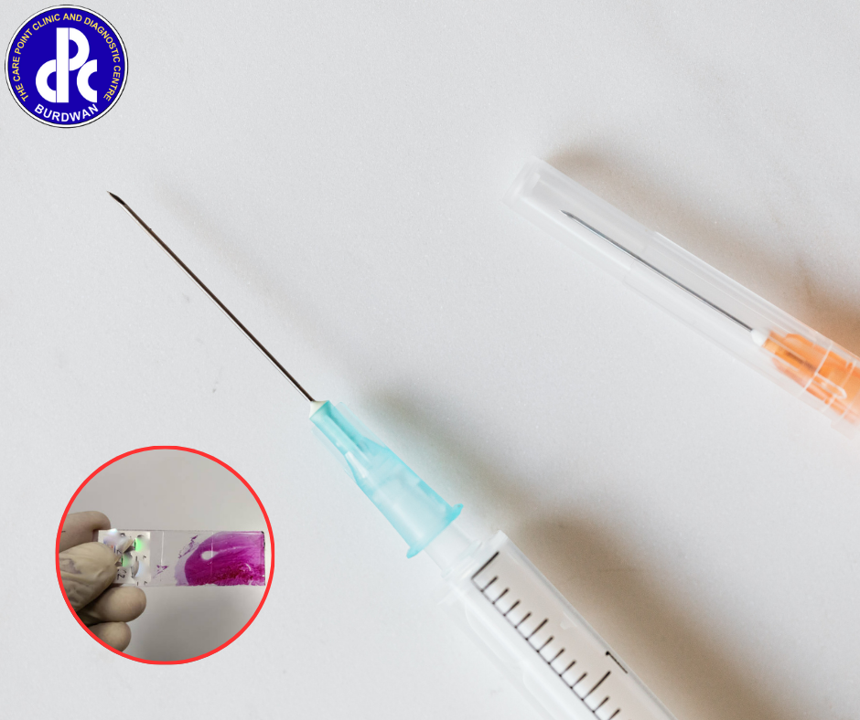 FNAC (Fine Needle Aspiration Cytology)